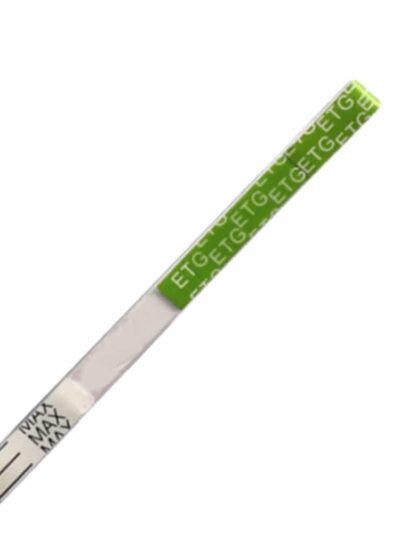 ETG Urine Test - UA Dip test