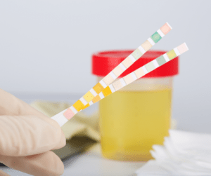 False Positive on Drug Test