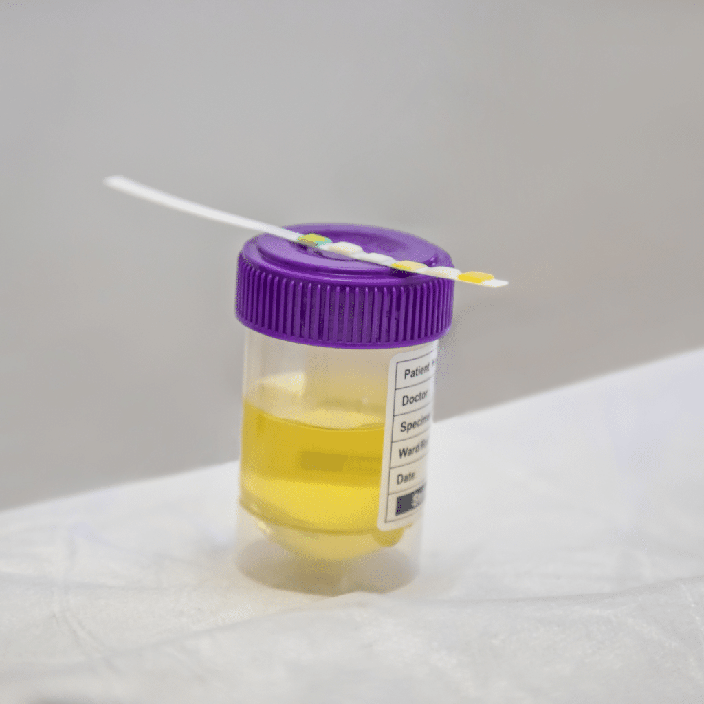 urine dip drug test
