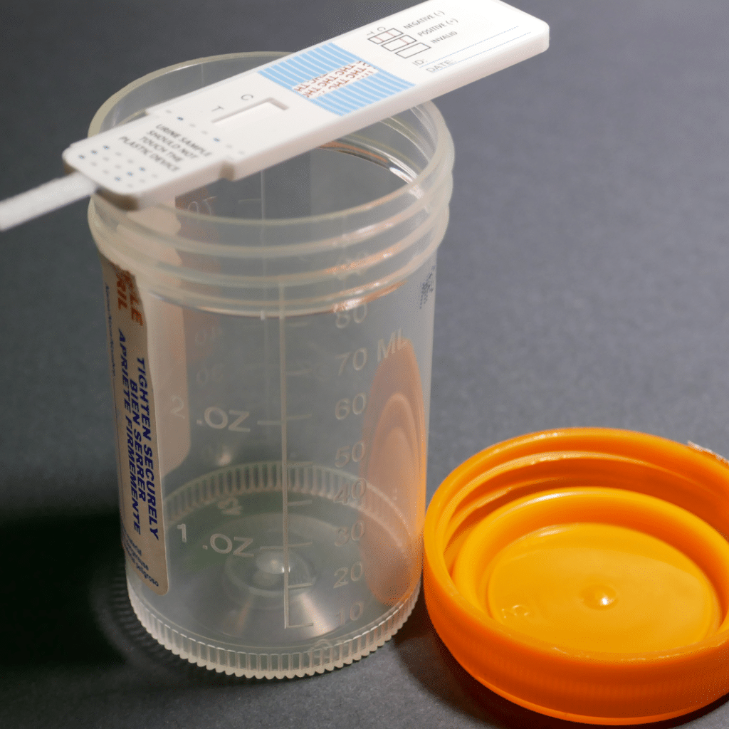 drug test for Xylazine