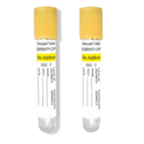 Vacuum Urine Tube Specimen