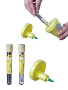 Urine specimen kit - urine specimen cup with needle and vacuum tube - Urine Container Kit /w Needle
