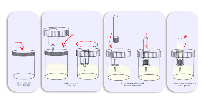 urine vacuum cup