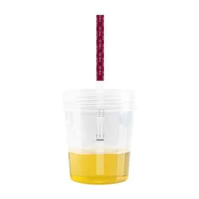 THC 20 test in urine sample