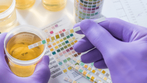 Drug test dip strip being read against a color chart next to a urine specimen cup