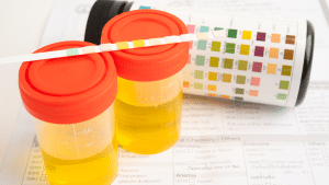 Drug test strip and laboratory request form for drug screening analysis