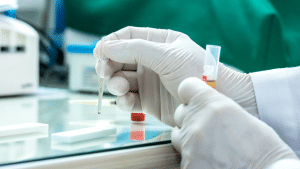 Lab technician in gloves handling a rapid test kit
