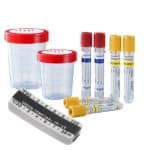 Lab cups, urine specimen, vacuum tubes